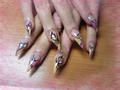 Anett