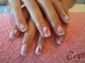 gel lac