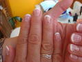 Shellac
