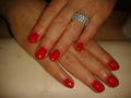 Gel lac