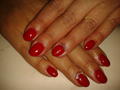 Gel lac