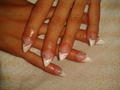 hegyes francia