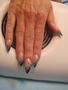 hegyes