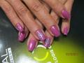 Gel lac
