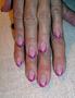 pinky2